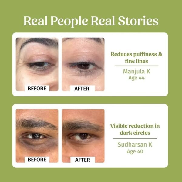 Dark circle brightening color corrector before and after under eyes